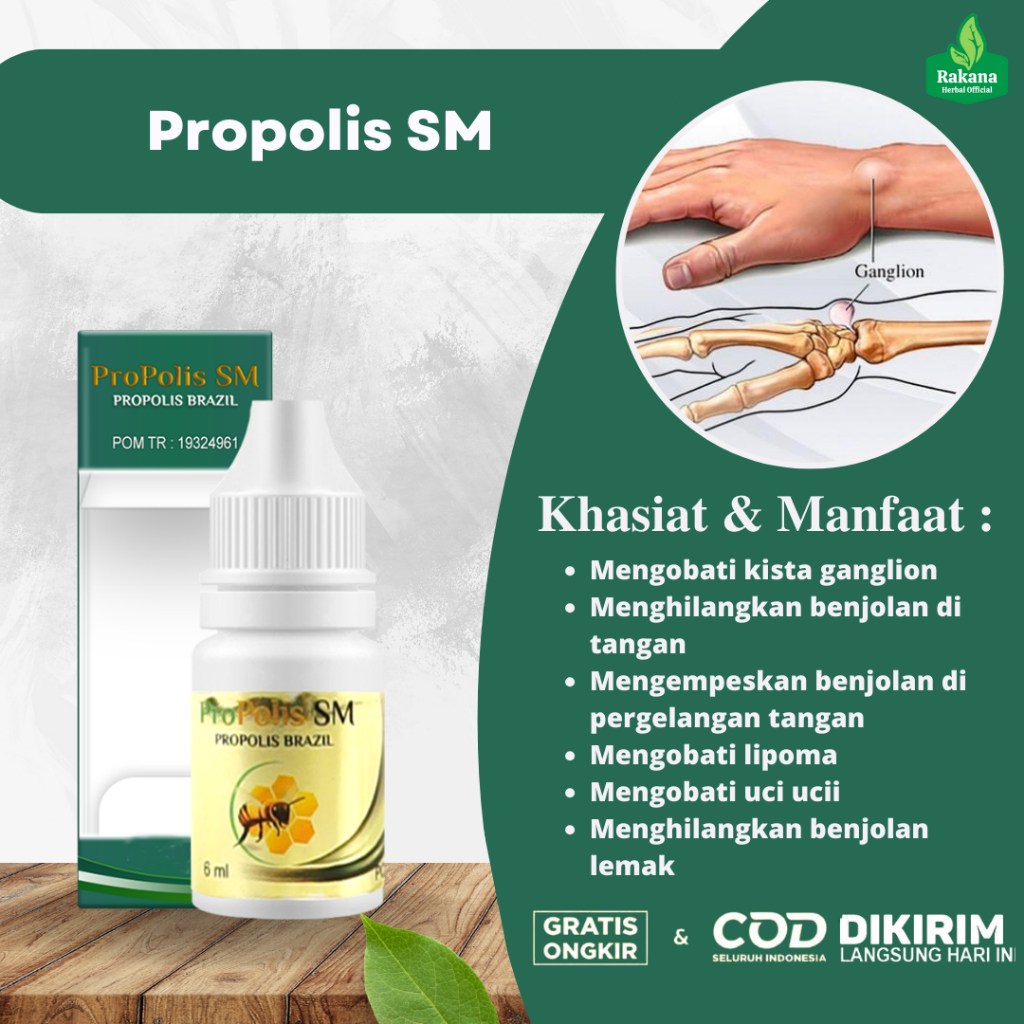 Obat Kista Ganglion Benjolan Di Tangan Penghilang Benjolan Di Tangan Pengempiis Benjolan Di Tangan U