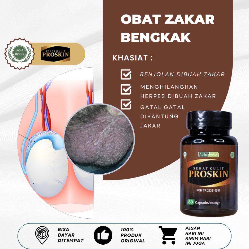 Obat Gatal Buah Zakar Pria, Obat Buah Zakar Bengkak Sebelah Kanan Kiri, Obat Testis Bengkak, Obat Bu