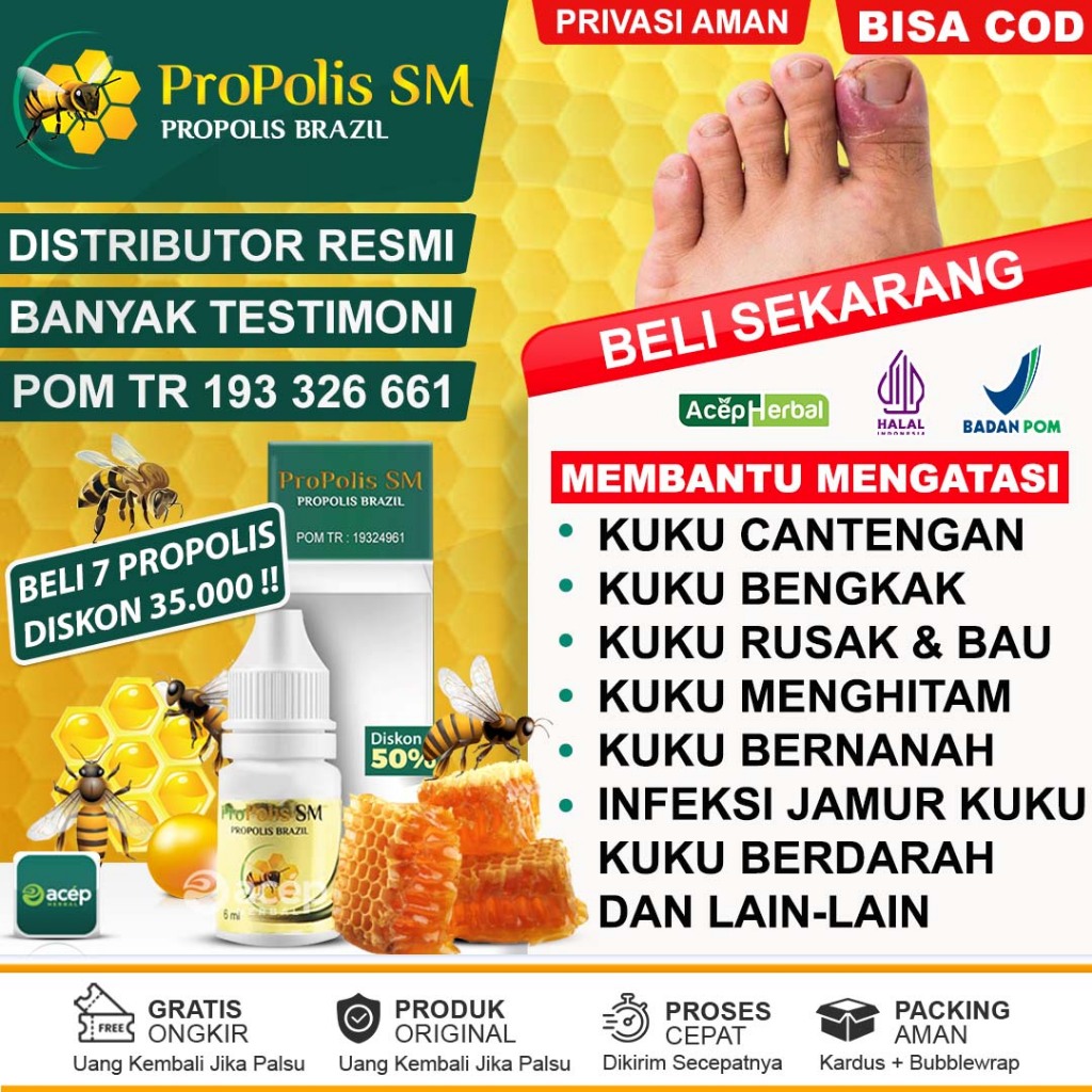 Obat Cantengan Jempol Tangan Kaki Bengkak Bernanah Berdarah Kuku Jamuran Kuku Rusak Bau Busuk Kuku K