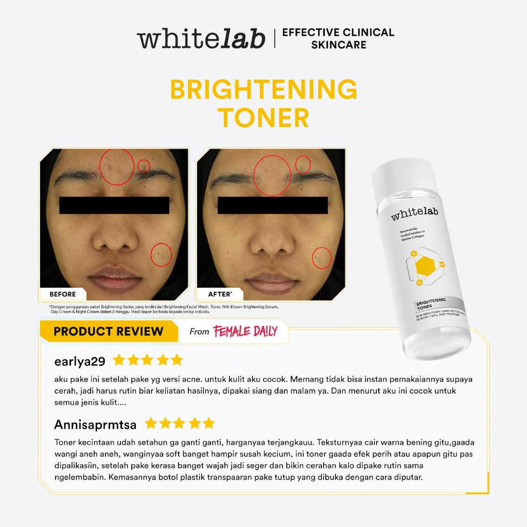 Whitelab Brightening Toner - Toner Pencerah Wajah Anti Kusam Dengan Niacinamide, Hyaluronic & Collagen [BPOM] Image 2