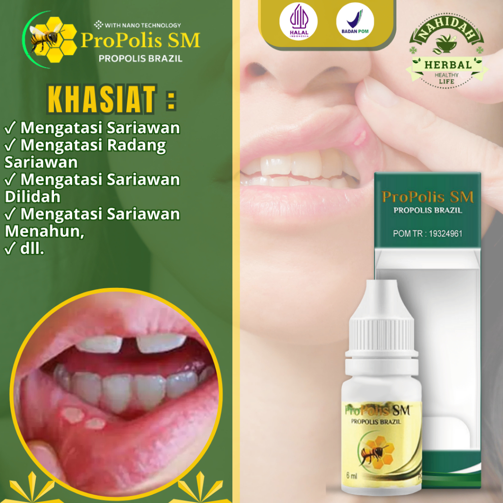 Obbat Sariawan, Obat Tetes Sariawan, Bibir Pecah Pecah Obat Sariawan di bibir, Sariawan Dilidah, Oba