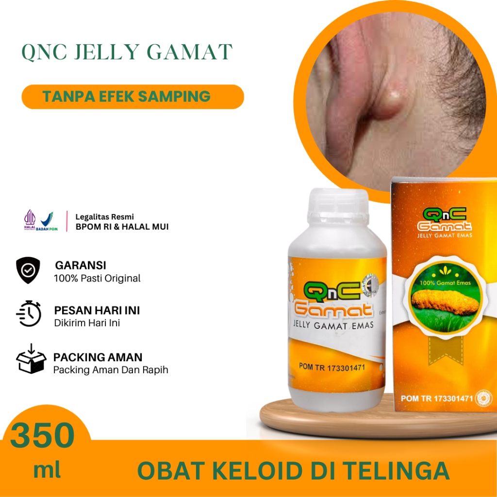 Obat Keloid Di Telinga, Benjolan Di Belakang Telinga, Keloid Menonjol Tahunan, Jerawat Di Telinga, B