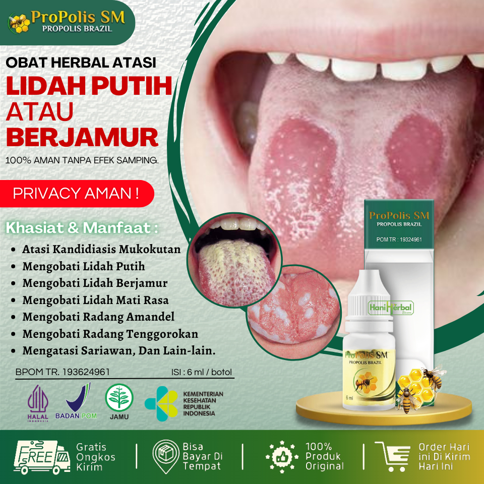 Obat Herbal Untuk Lidah Berjamur, Pembersih Lidah Berjamur Alami, Penghilang Jamur / Bercak Putih di