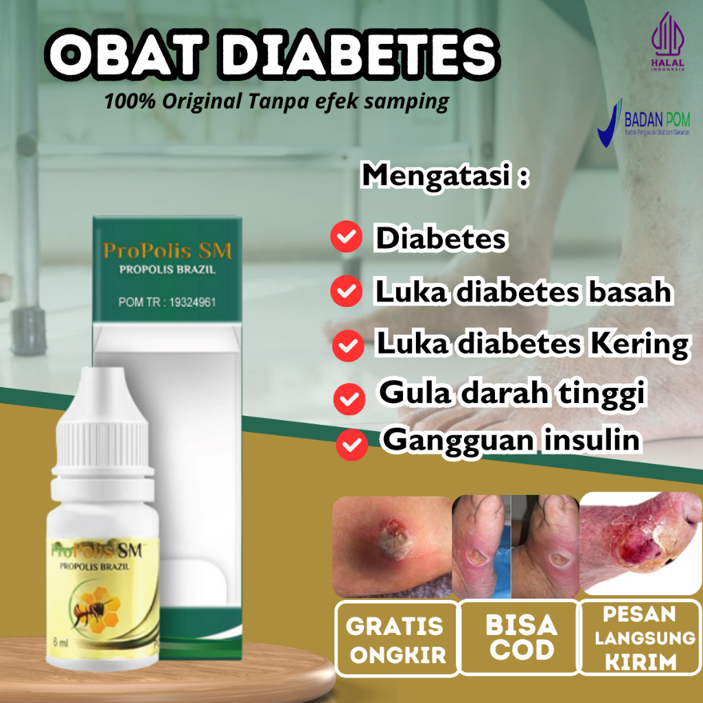 Salep Diabetes basah, Obat Diabetes kering, Obat Pengering Luka Diabetes Basah Bernanah, Obat Koreng