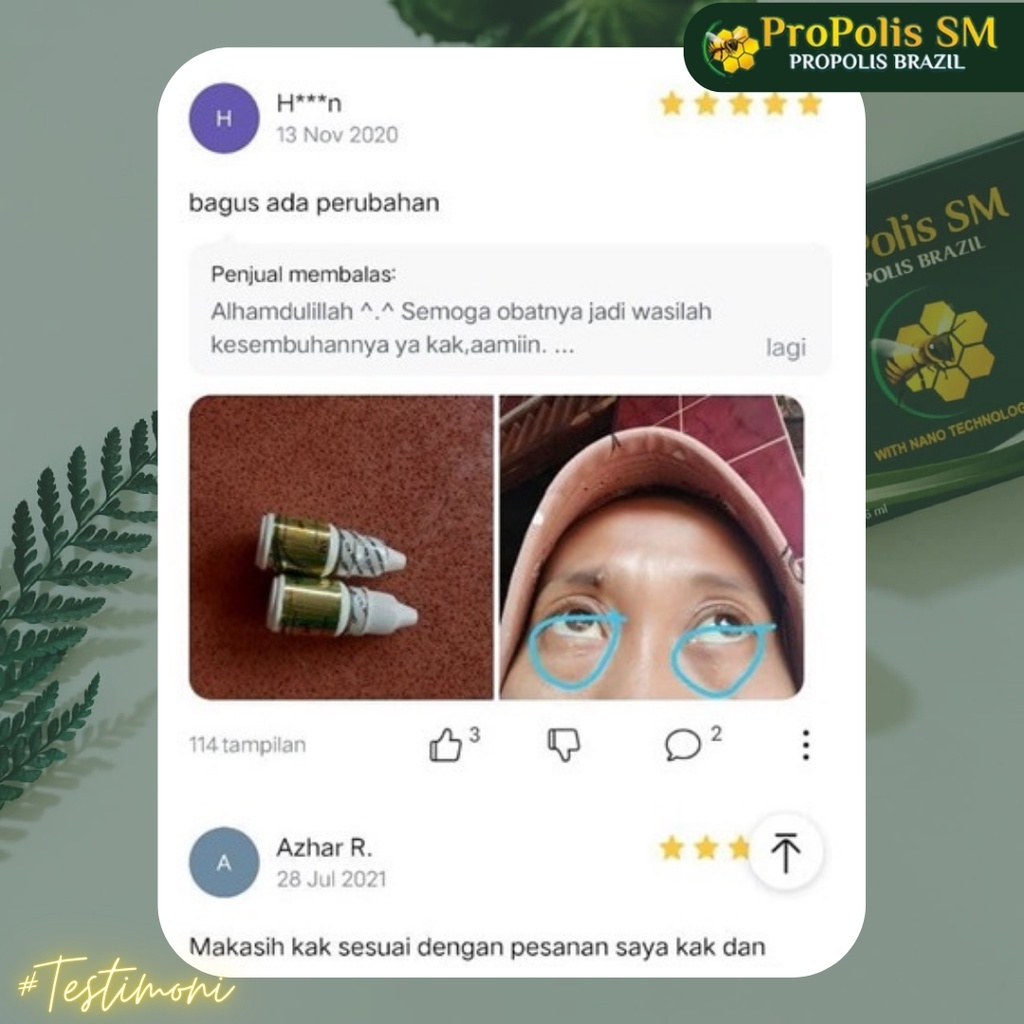 Obat Xanthelasma, Obat Penghilang Xanthelasma, Obat Gumpalan Lemak Di Kelopak Mata, Obat Plak Kuning