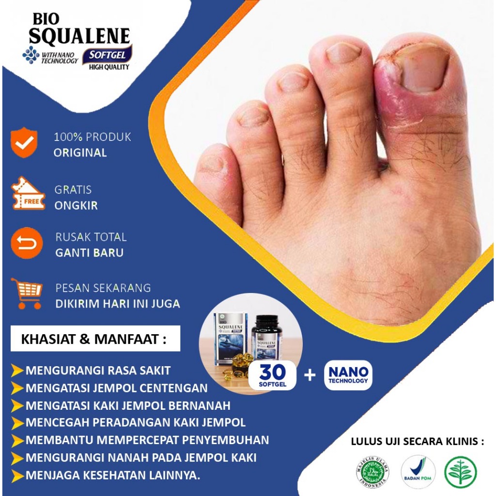 Obat Bengkak Jempol Kaki, Obat Jempol Kaki Bengkak, Obat Jempol Kaki Cantengan, Kaki Cantengan, Kuku