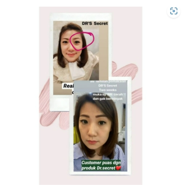 SKIN CARE DR'S SECRET AESTIER EYE CREAM