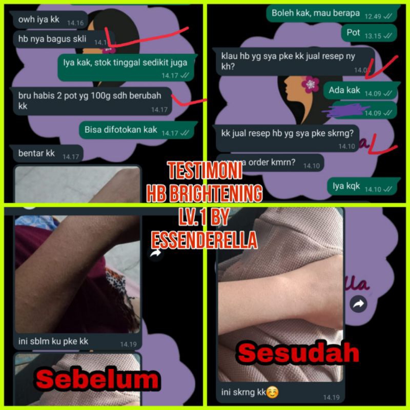 HB Brightening Level 1