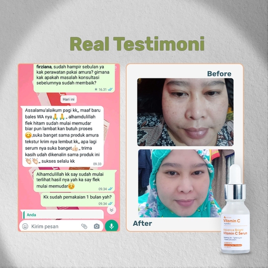 Amura TwinPack  Vit C Serum - Spesialis Hilangkan Kusam &amp; Cerahkan Wajah
