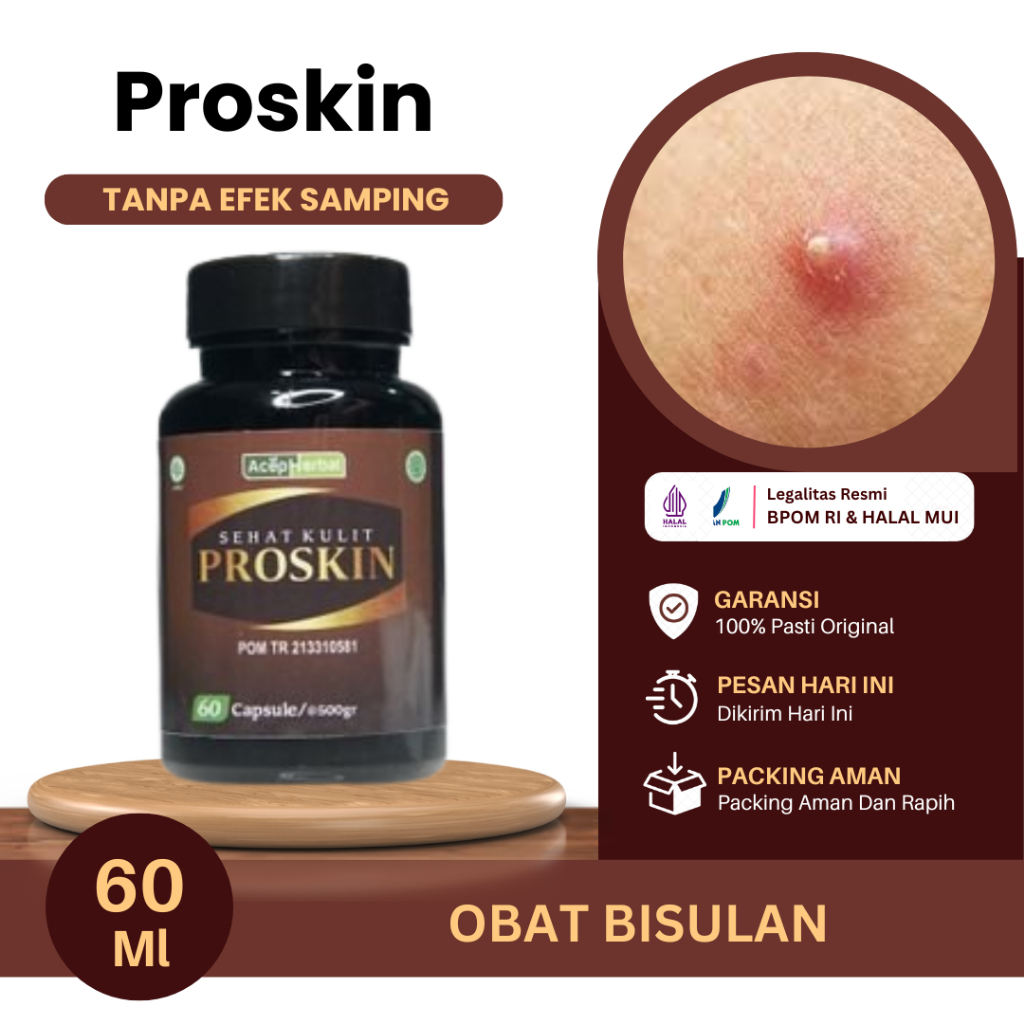 Obat Bisulan, Bisulan Gak Tumbuh Lagi, Bisul Di Kepala, Bisul Telur kodok, Bisul Di Tangan, Di Kaki,