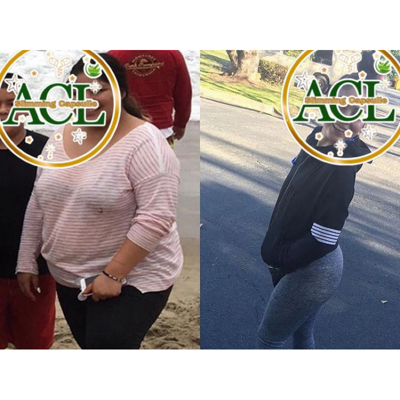 ACL Slimming Capsule | Kapsul Pelangsing Cepat Turun Slimming Herbal Pil Diet Aman Dan Ampuh Menurun
