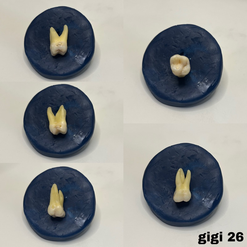 Molar 1 atas ( 16 26 ) gigi praktikum asli graham