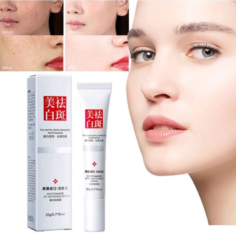 RFUYAN Nicotinamide Spot Whitening Cream