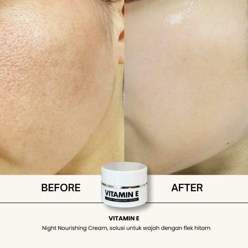 Louvrea Vitamin E/skincare Louvrea vitamin E/pelembab untuk wajah flek