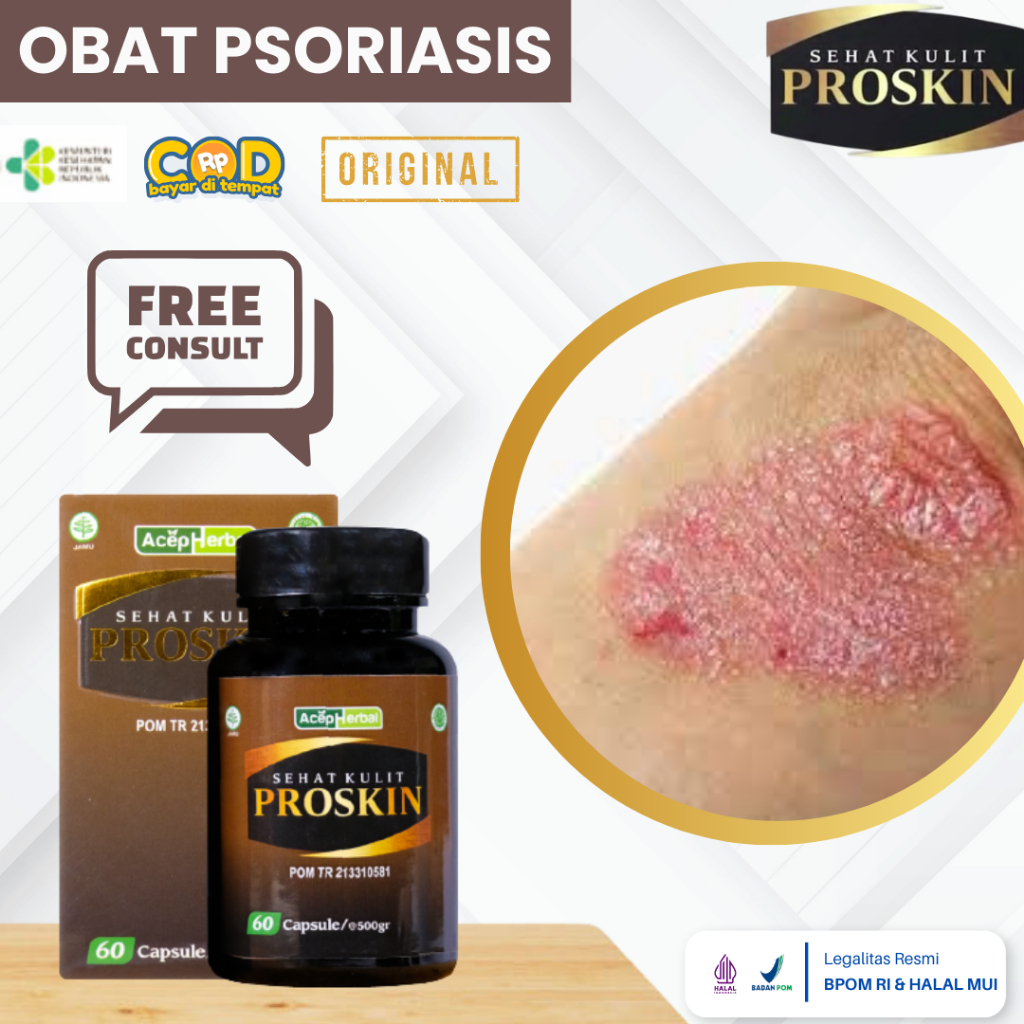 Obat Psoriasis Kulit, Obat Kulit Bersisik Di Siku Tangan, Obat Kulit Bersisik Dan Tebal, Kulit Kerin