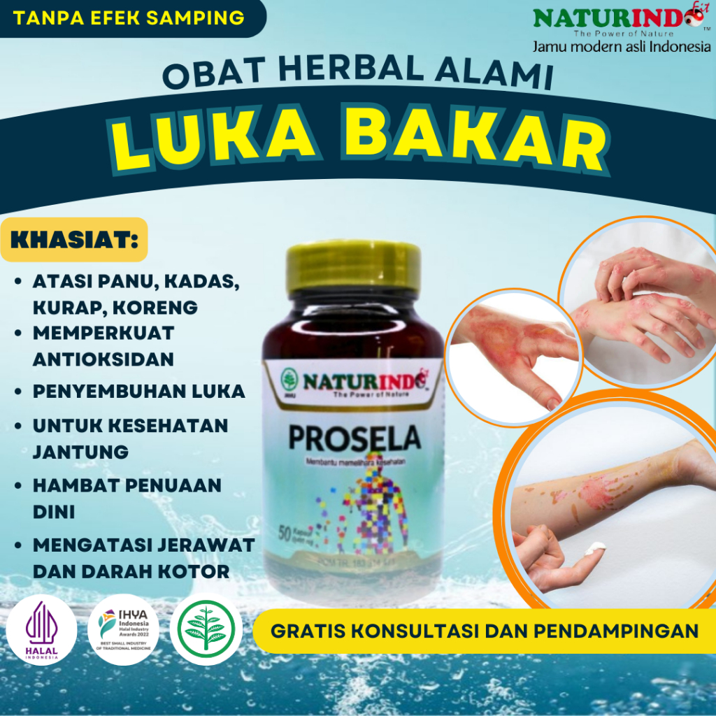 Obat Luka Bakar Paling Ampuh Sembuh Knalpot Minyak Panas Obat Luka Cepat Kering Obat Penghilang Beka