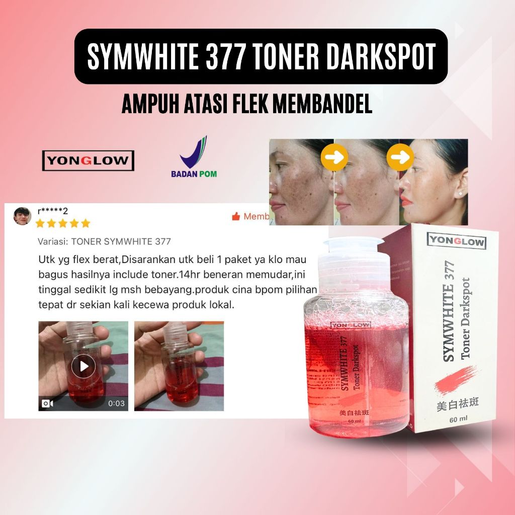 Toner Symwhite 377 Yonglow BPOM Toner Flek Cina Ampuh Toner Penghilang Flek Hitam Melasma Hiperpigme