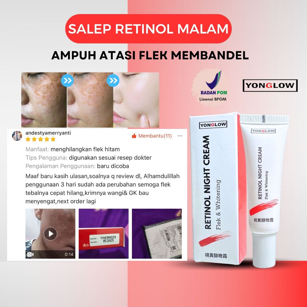 Salep Cina Retinol Yonglow Skincare BPOM Salep Malam Flek Noda Hitam Bintik Melasma Wajah Cream Anti