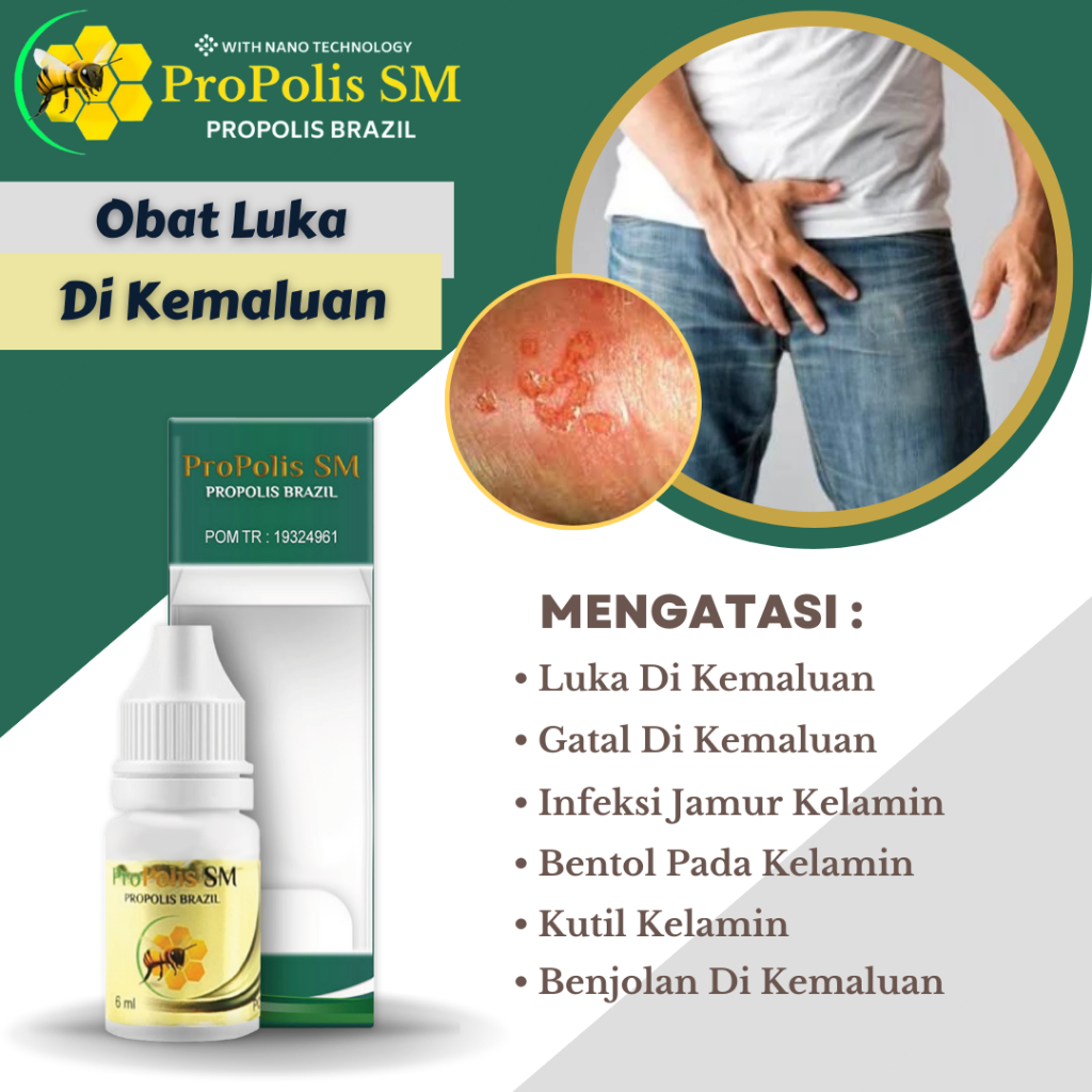 Obat Luka Pada Kemaluan, Kemaluan Lecet dan Perih, Gatal Pada Kemaluan, Obat Luka Kelamin Pria, Peni
