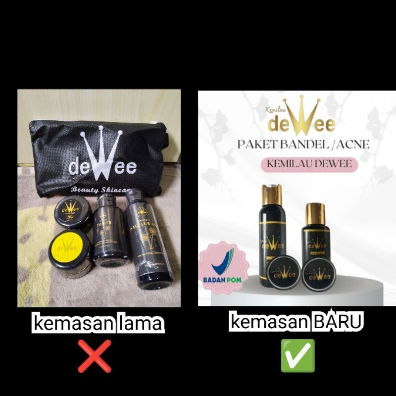 Dewee skincare flek/acne/susah putih