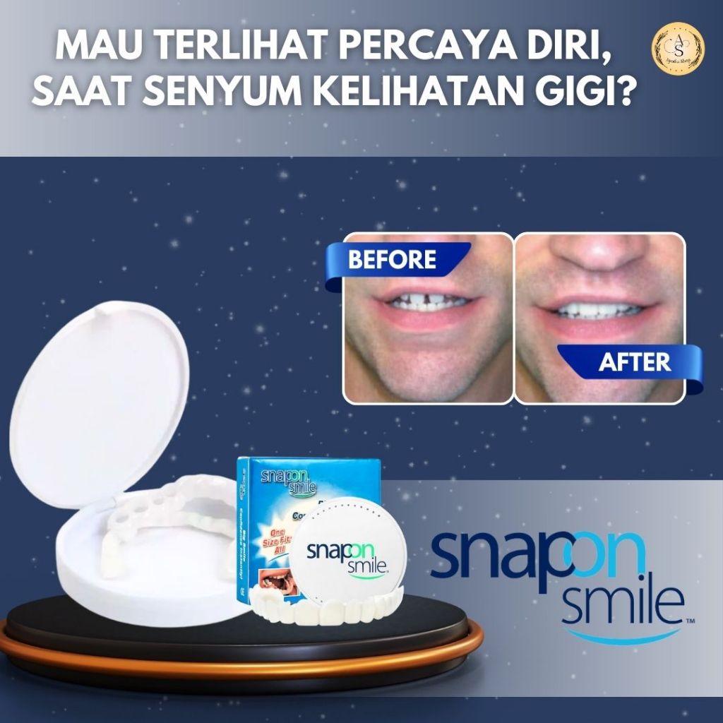 Snap On Smile Veneer Vener Venner Veener Venerr Viner Alat Pemutih Gigi Palsu Instan Silikon teeth w