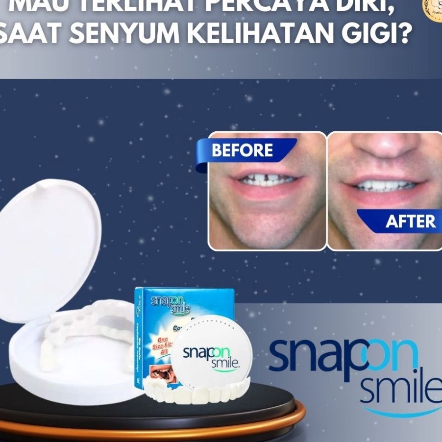KP8 Snap On Smile Veneer Vener Venner Veener Venerr Viner Alat Pemutih Gigi Palsu Instan Silikon tee