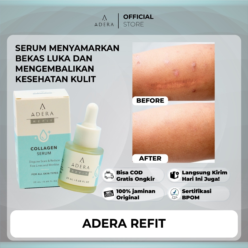 [COD SERUM FLEK] ADERA REFIT Collagen Serum Menyamarkan Bekas Luka dan Mengembalikan Kesehatan Kulit