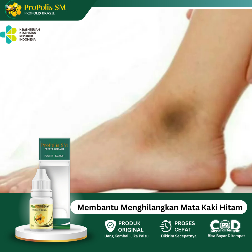 Obat Pemutih Mata Kaki Hitam, Obat Mata Kaki Kasar, Obat Mata Kaki Kering, Obat Nyeri Mata Kaki Akib