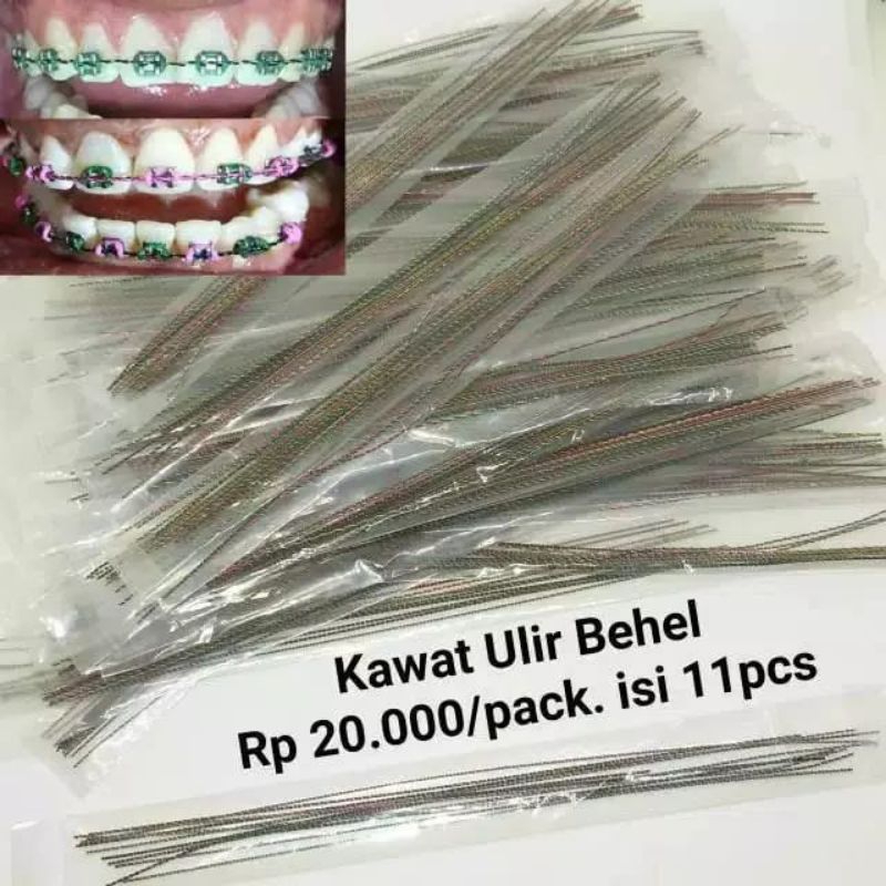 Kawat Ulir Warna / Kawat Ulir Behel