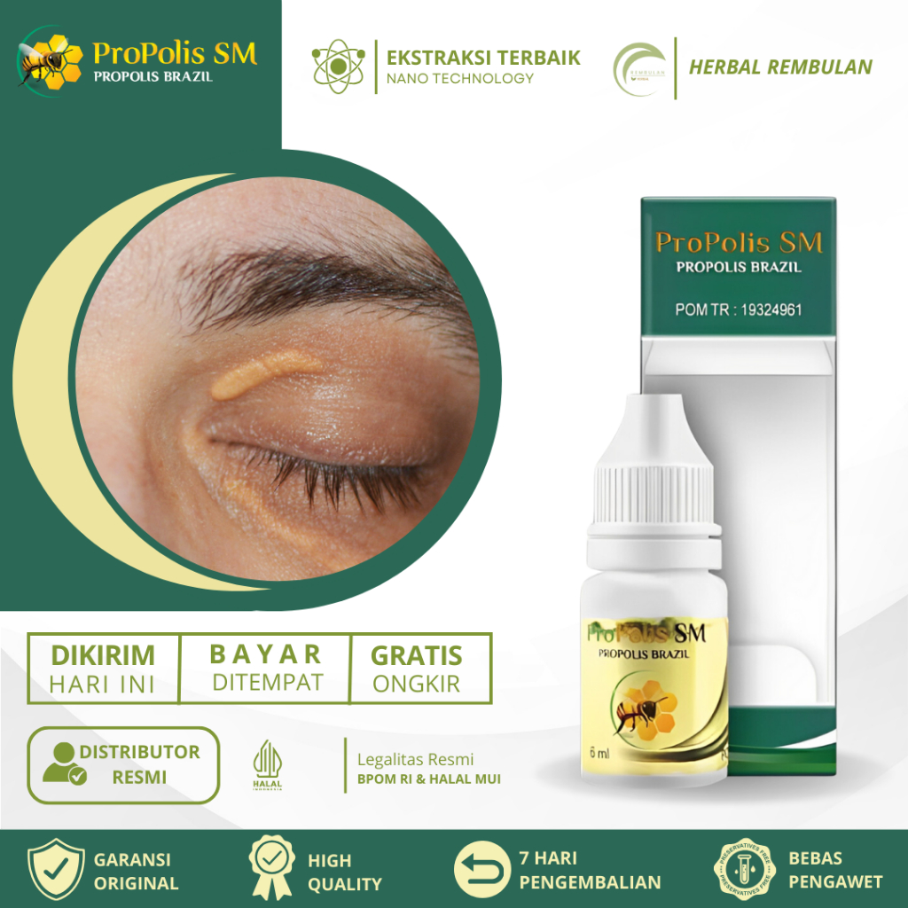 Obat Xanthelasma, Obat Penghilang Xanthelasma, Obat Xanthelasma Penghilang Gumpalan Lemak Di Sekitar