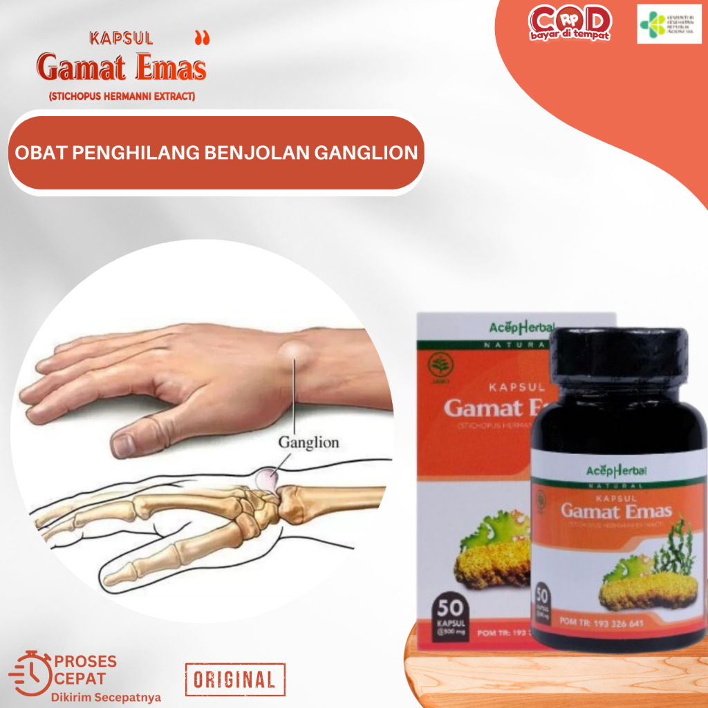Obat Penghilang Benjolan Ganglion, Obat Kista Ganglion, Obat Benjolan Lipoma, Obat Benjolan Di Tanga