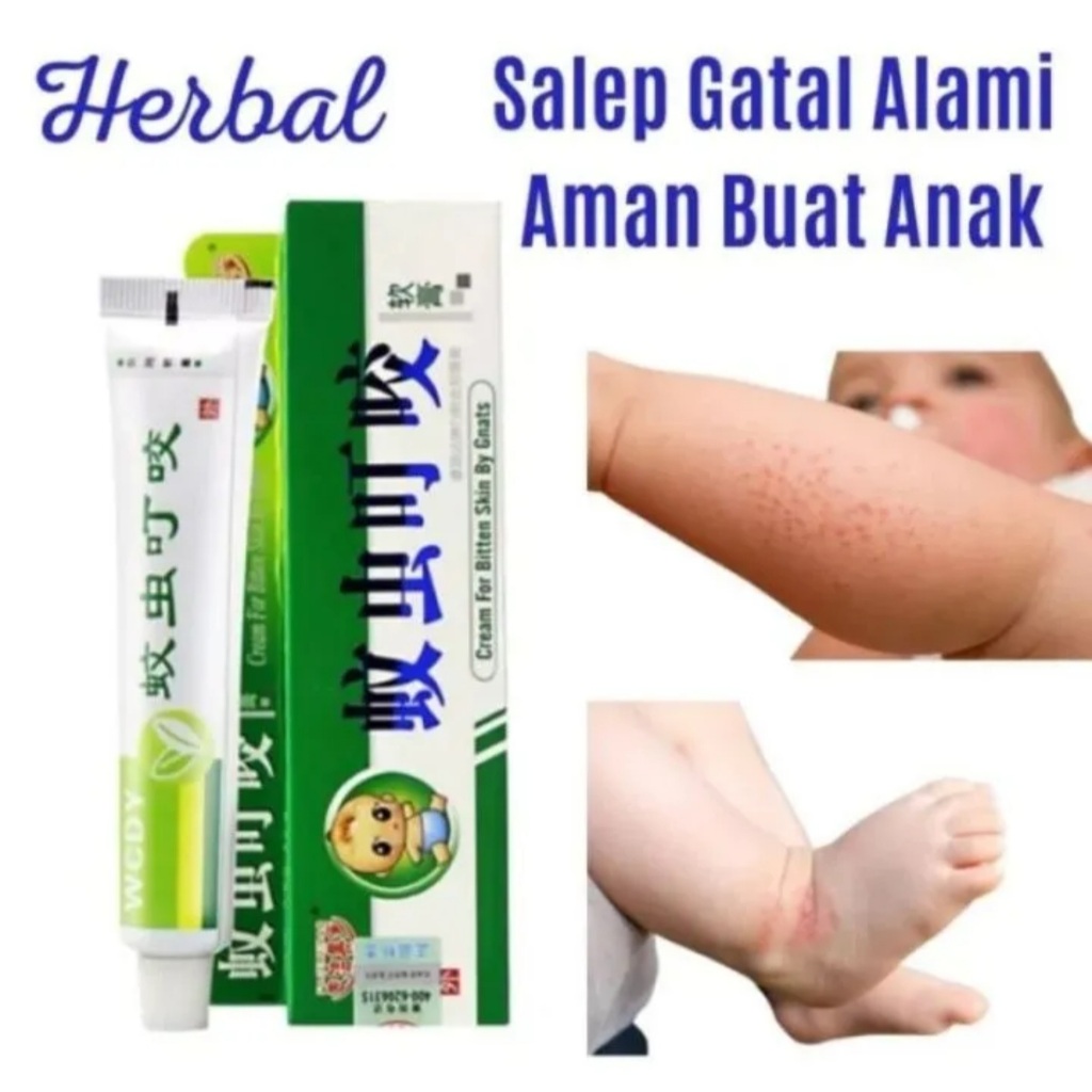 Obat Salep Gatal Anak-Anak / Krim Alergi Aman Untuk Bayi Anak Balita / Obat Gigitan Serangga / Salep