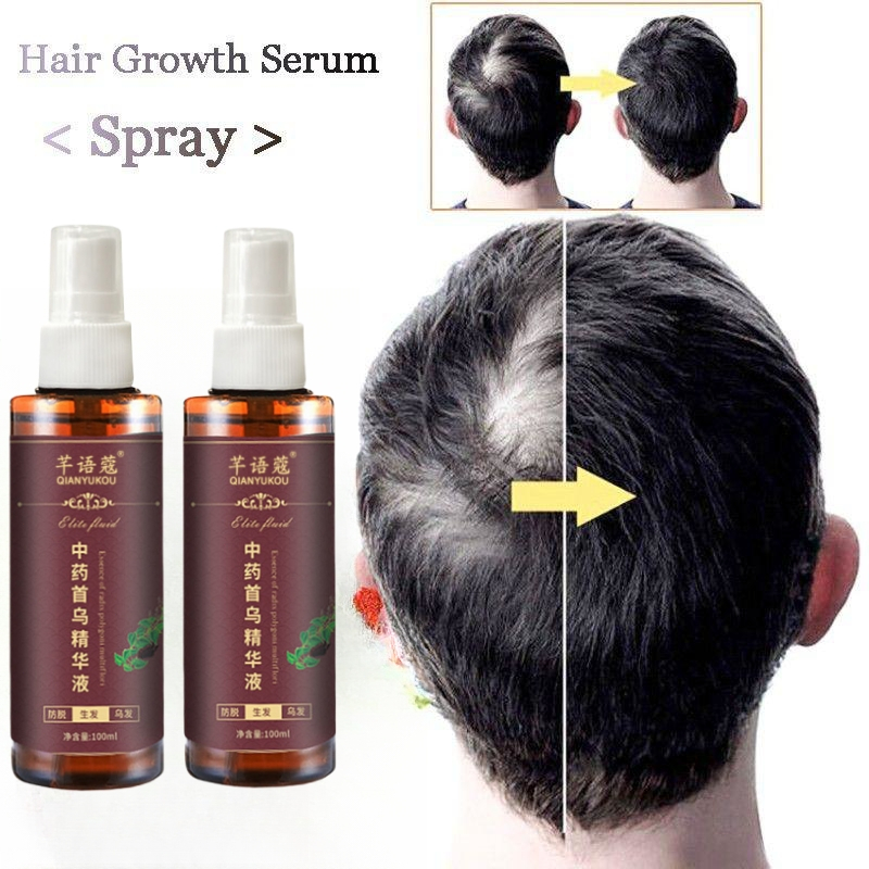 Obat Serum Penumbuh Rambut Obat Rambut Cepat Rontok / Obat Penumbuh Rambut Botak Pria / Wanita - Hair Growth Serum - Penumbuh Rambut Cepat