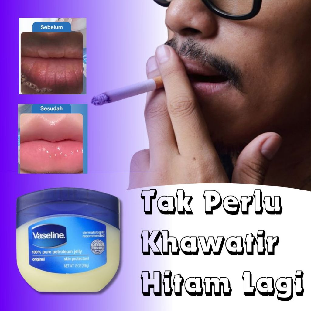 Vaseline Lip Balm Original Pemerah Bibir Permanen Lipbalm Pencerah Bibir Hitam Mencerahkan Perokok
