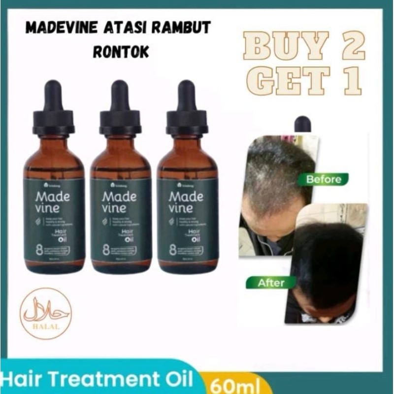 MADEVINE Hair Oil dan Shampoo Paket Perawatan Rambut Rontok dan Penumbuh