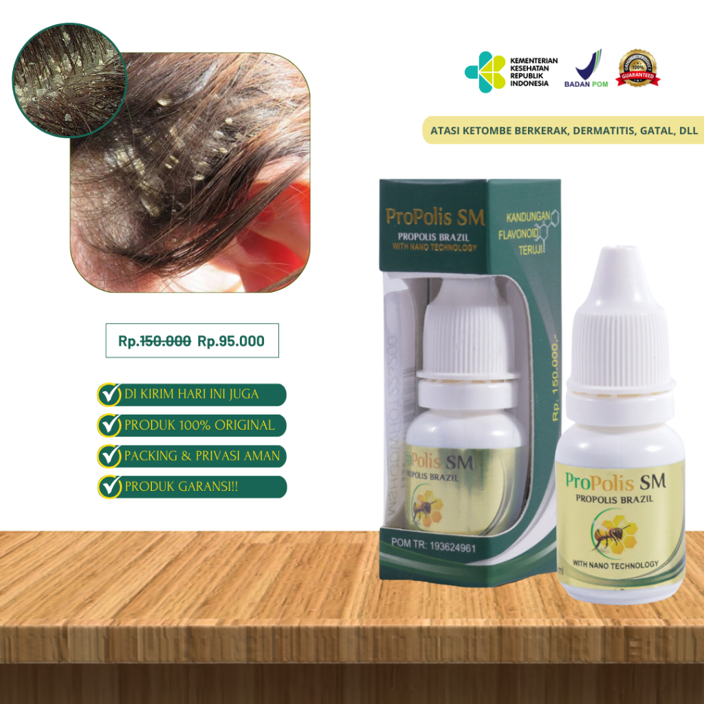 Obat Ketombe|Anti Ketombe|Obat Ketombe Rambut|Ketombe Berkerak|Obat Penghilang Ketombe|Obat Ketombe 