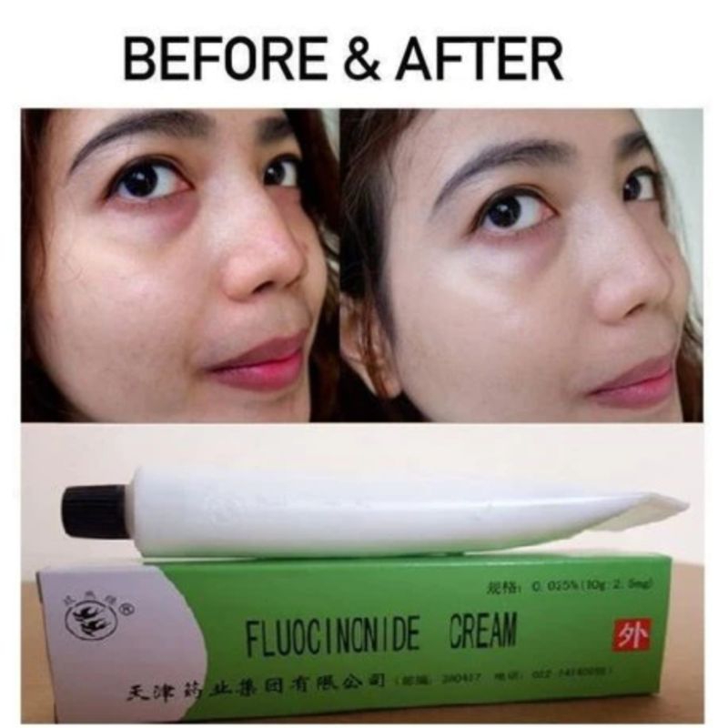 salep walet penghilang flek hitam/ jerawat dan gatal