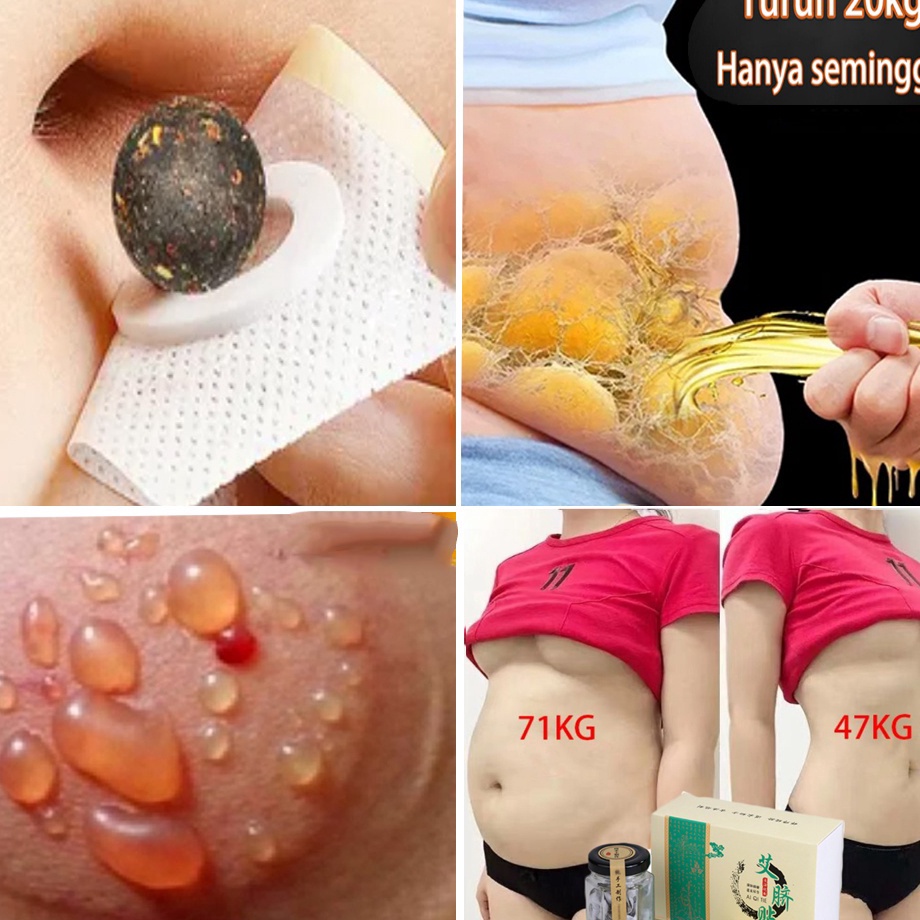 TERBARU 1 Ori3pcs Obat Pelangsing Badan Cepat Dan AmpuhSlim Patch Koyo PelangsingAlat Pelangsing Per
