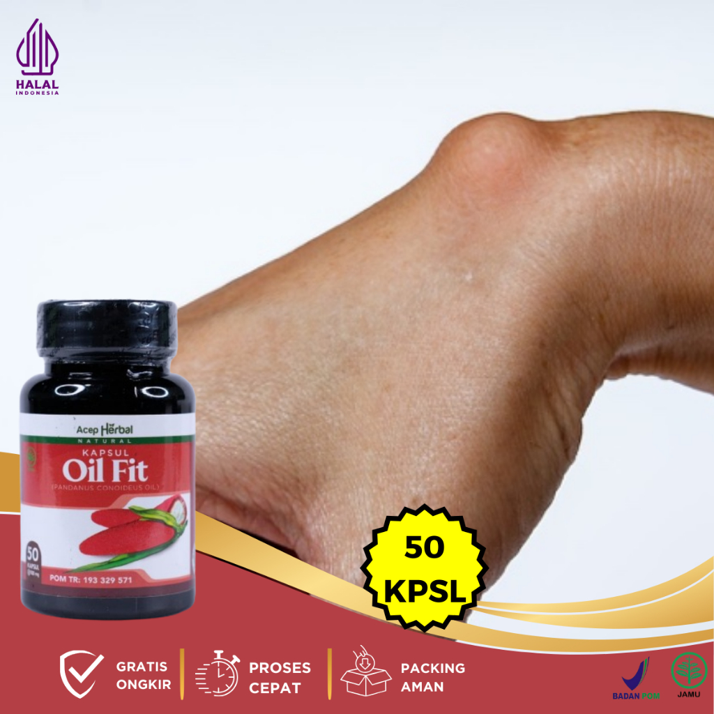 Obat Kista Ganglion, Obat Benjolan Di Tangan, Obat Penghilang Benjolan Di Tangan, Obat Herbal Kista 