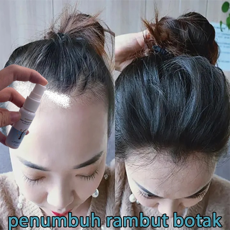 Penumbuh rambut botak penebal rambut penumbuh rambut cepat serum penumbuh rambut 30ml serum rambut r