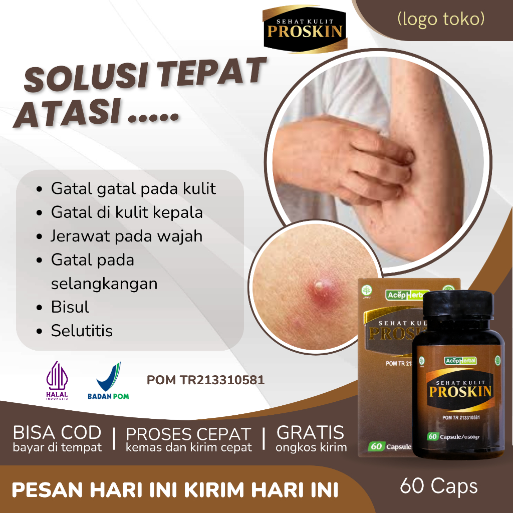 Obat Beruntusan Bruntusan di Punggung, Obat Gatal Scabies, Obat Gatal Eksim, Obat Gatel Bruntus, Oba