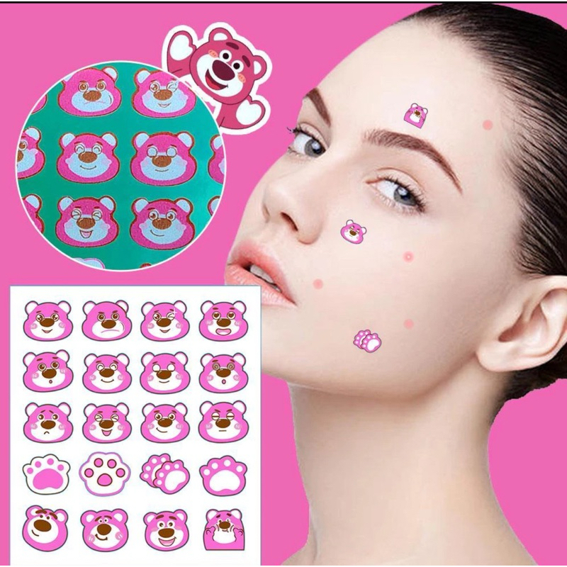 Acne Pimple Patch Lotso Toy Story Sticker Jerawat Stiker Acne Patch 1 Lembar