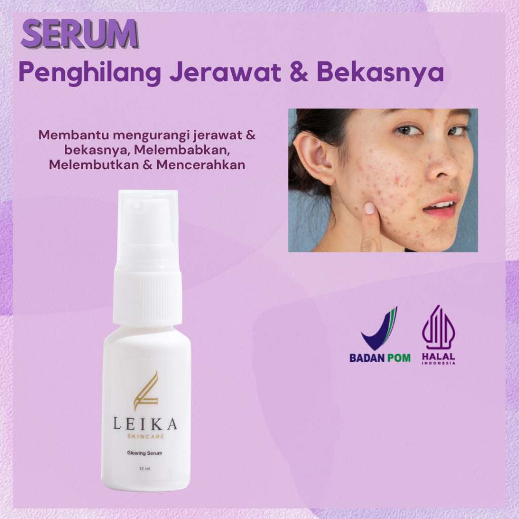 [SERUM] Penghilang Jerawat Dan Komedo Penghilang Jerawat Dan Bekas Jerawat Penghilang Jerawat Dan Br