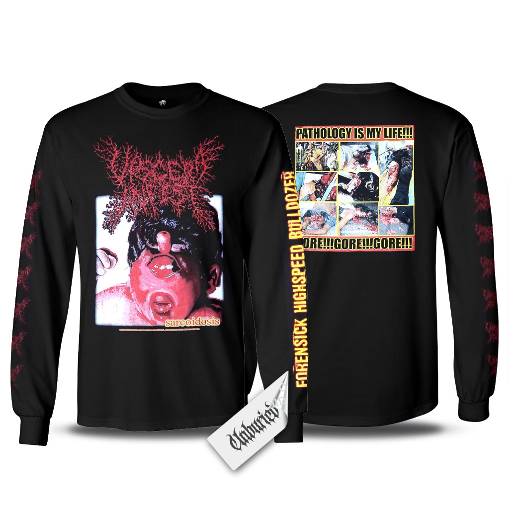 Long Sleeve - Viscera Infest - Sarcoidosis