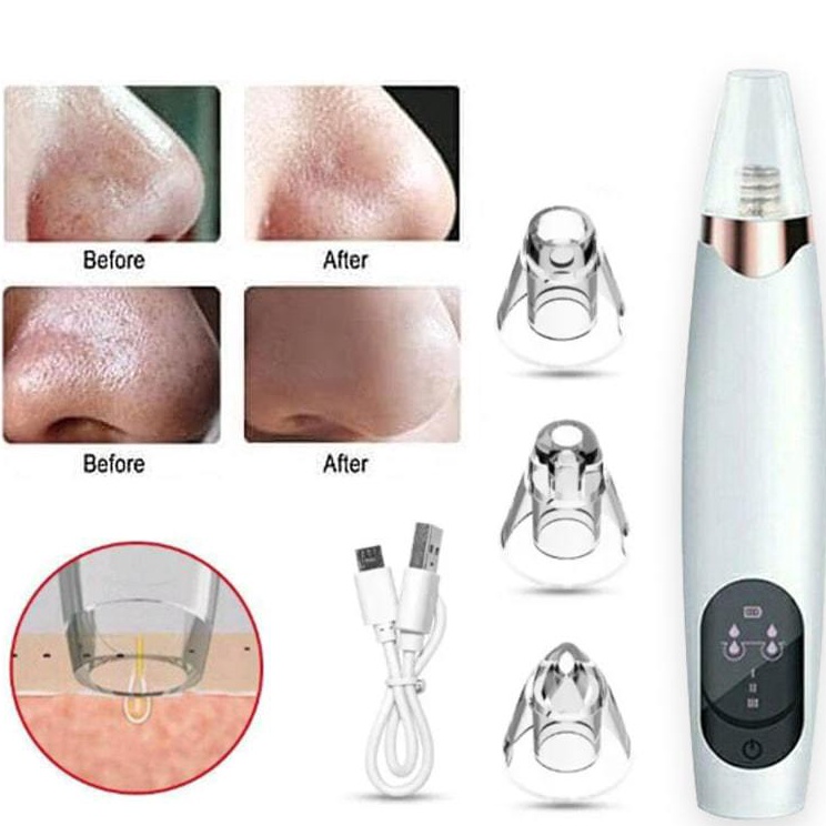 Remove Blackhead Alat Vacum Penyedot Komedo  Alat Penyedot Komedo Sedot Komedo Alat Penghilang Penye