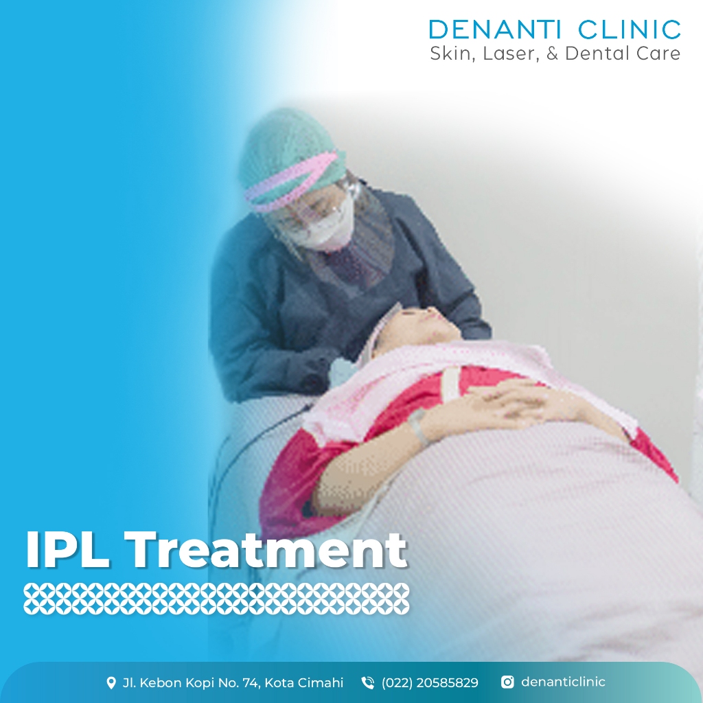 Photo Shower - IPL Treatment