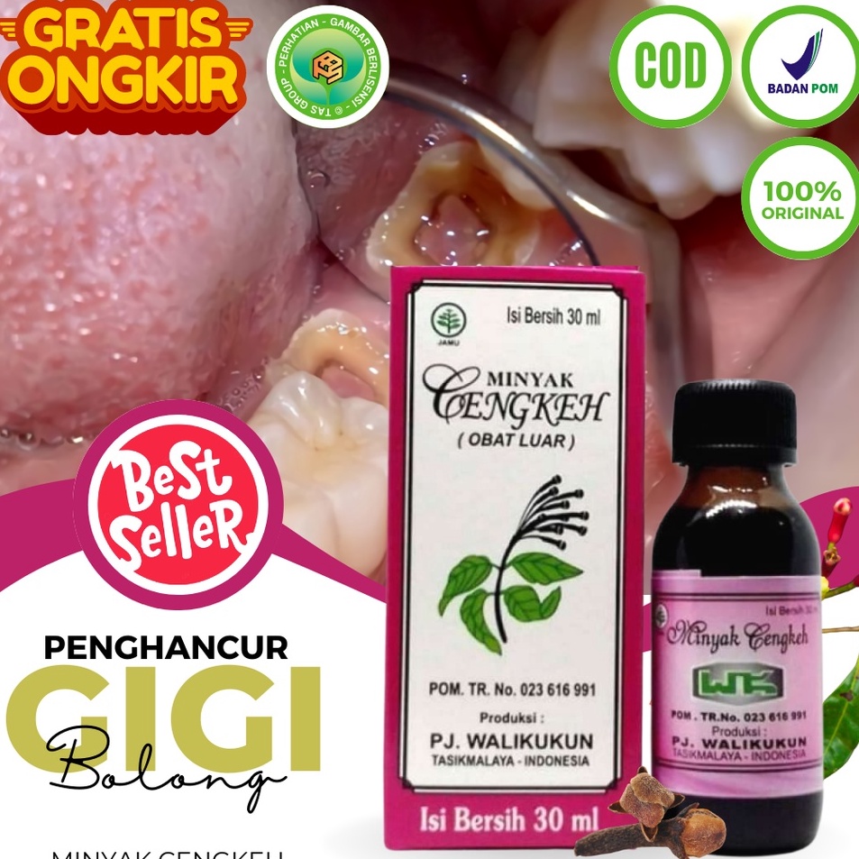 Sakit Gigi Berlubang Ampuh Minyak Cengkeh Murni Sakit Gigi Semprot Penghancur Perontok Gigi Berluban