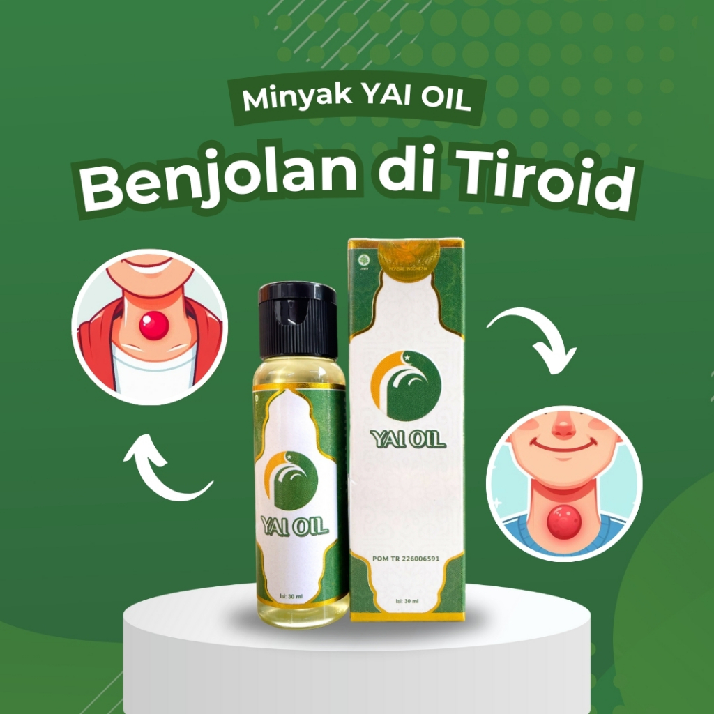 YAI OIL UNTUK BENJOLAN TIROID / OBAT OLES UNTUK TIROID