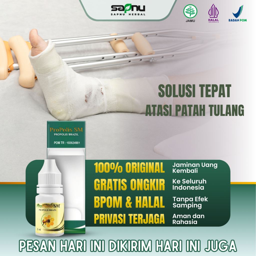 ProPolis SM - Obat Patah Tulang, Obat Patah Tulang Tangan, Obat Patah Tulang kaki, Obat Patah Tulang
