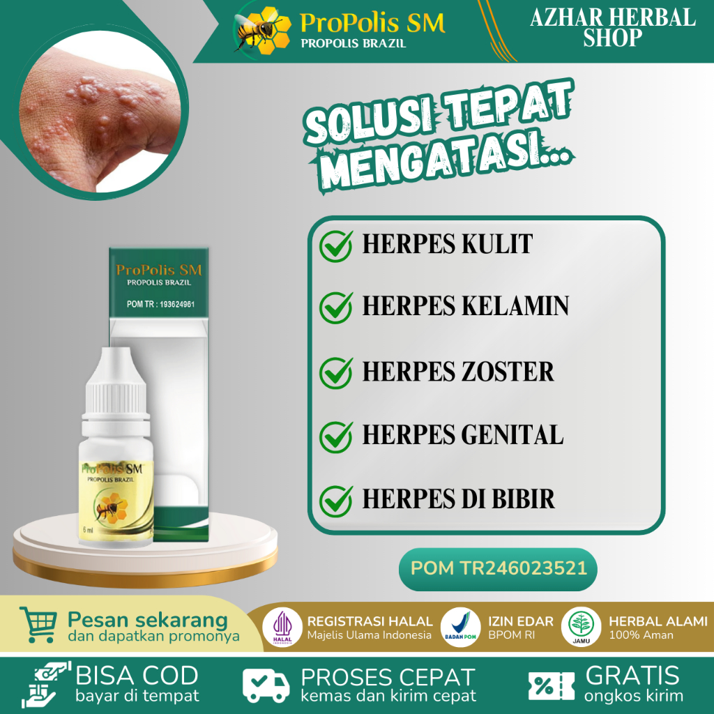 Propolis SM Obat Herpes, Kulit, Kelamin, Herpes di Bibir, Herpes Zoster, Herpes Bayi, Herpes Genital
